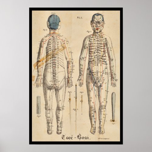 Vintage French 1825 Acupuncture Meridian Points Poster