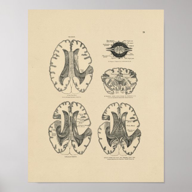 Vintage Human Brain Anatomy 1880 Print (Front)