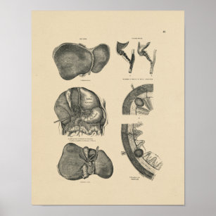 Vintage Liver Anatomy 1880 Print