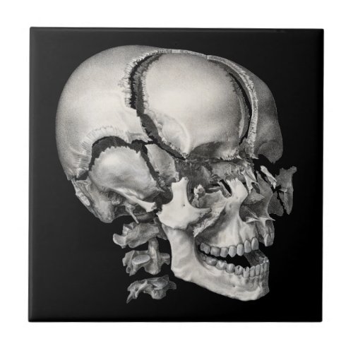 Vintage Science Human Anatomy Antique Skull Ceramic Tile