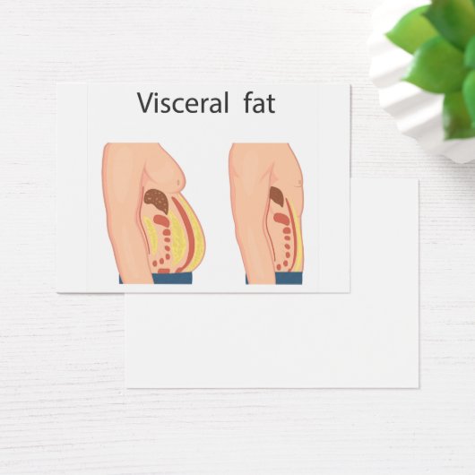 Visceral fat (Desk)