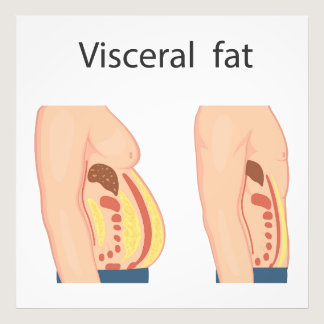 Visceral fat photo print