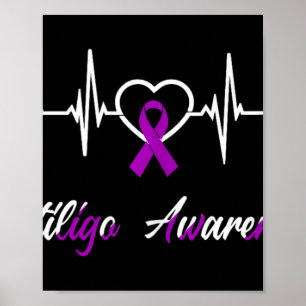 Vitiligo Awareness Heartbeat Love Purple Ribbon Su Poster