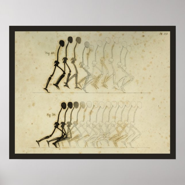 Walking Gait Analysis Leg Spine Chiropractic Chart (Front)