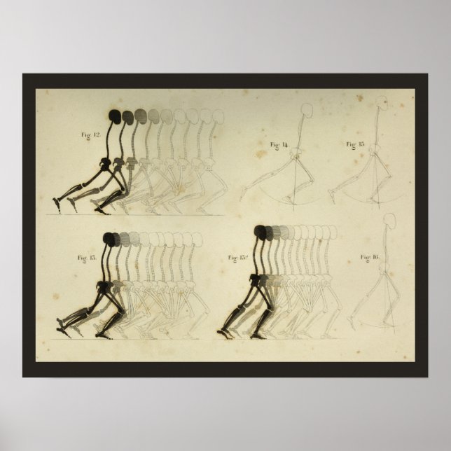 Walking Gait Analysis Leg Spine Chiropractic Chart (Front)