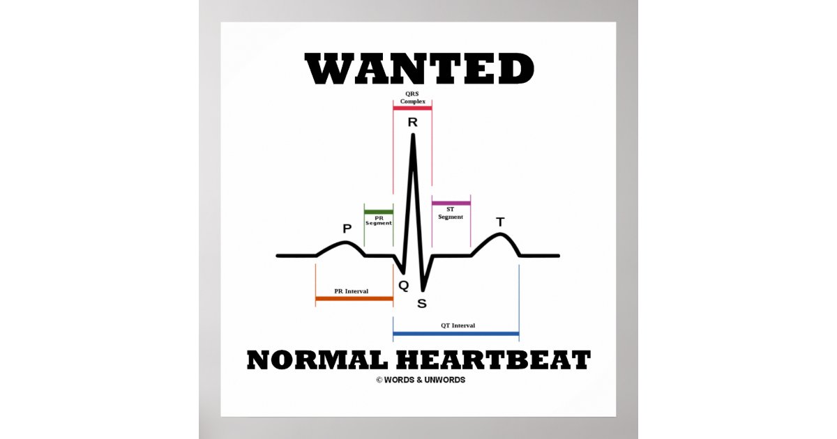 kapitalisme Utrolig hylde Wanted Normal Heartbeat ECG Electrocardiogram Poster | Zazzle