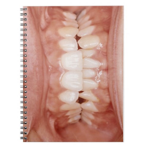 Weird Unusual Gory Teeth Gums Photo Notebook
