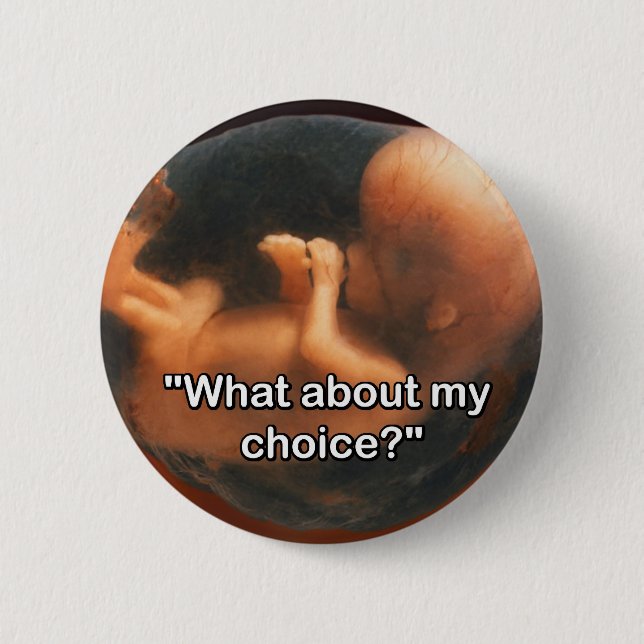 "What about my choice?" Pinback Button (Front)
