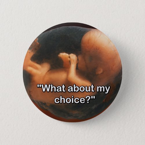 What about my choice Pinback Button