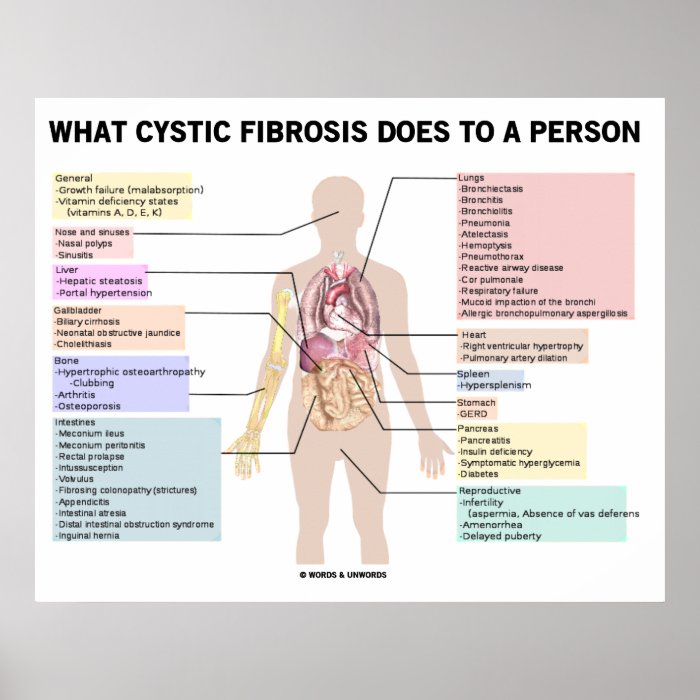 What Cystic Fibrosis Does To A Person (Anatomical) Posters