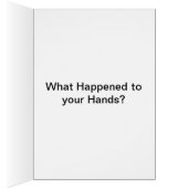 What happened to your Hands Cards (Inside (Right))