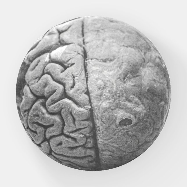 What's on your mind? Dome Paperweight (Front)