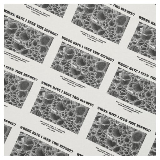 Where Have I Seen This Before? Vascular Bundle Fabric