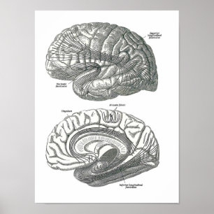 White Matter Tracts of the Brain Poster