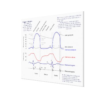Wiggers Diagram Canvas Print | Zazzle