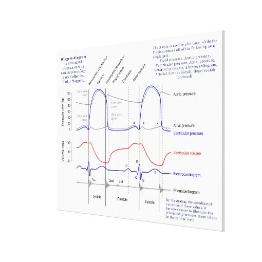 Wiggers Diagram Canvas Print | Zazzle