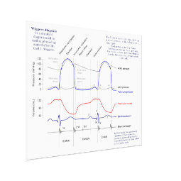 Wiggers Diagram Canvas Print | Zazzle
