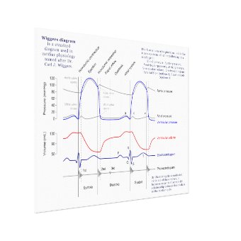 Wiggers Diagram Canvas Print | Zazzle