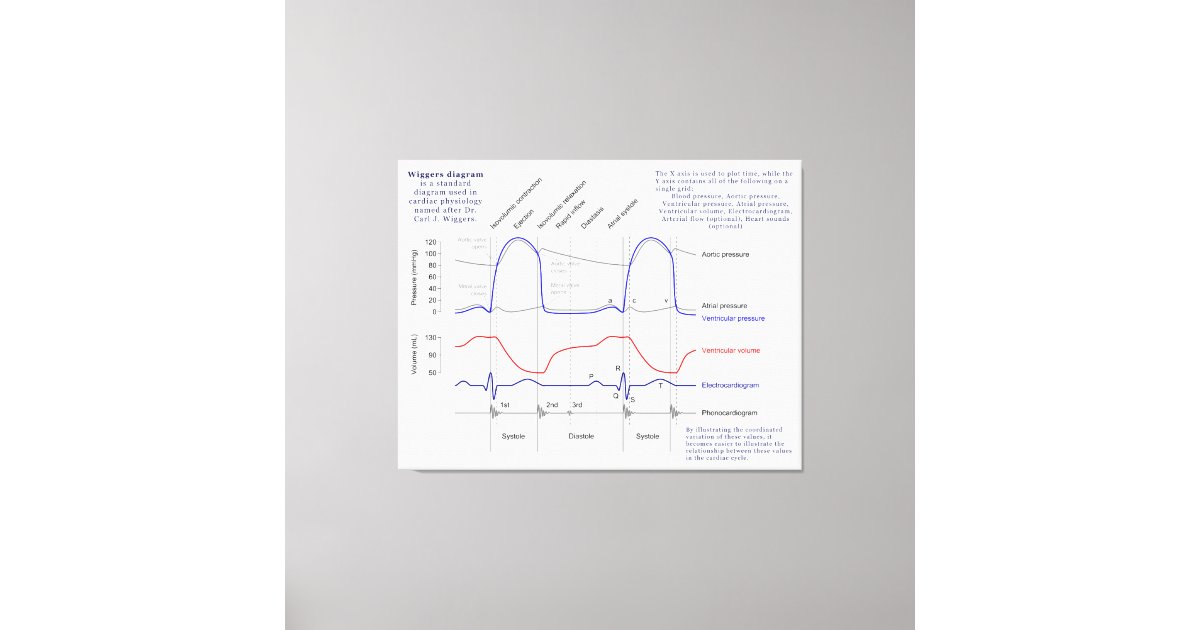 Wiggers Diagram Canvas Print | Zazzle