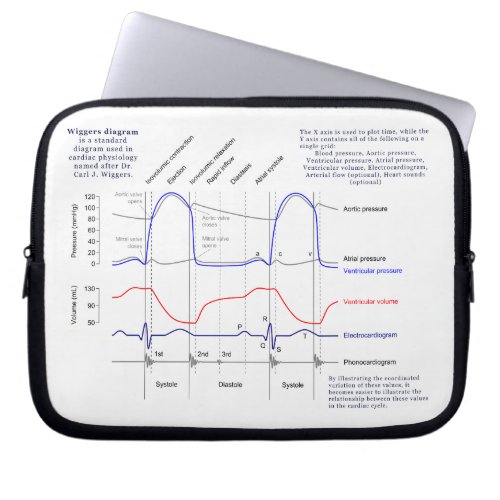 Wiggers Diagram Laptop Sleeve