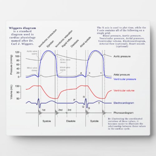 Wiggers Diagram Plaque