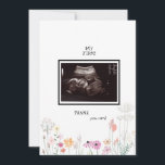 Wildflowers Ultrasound Photo Thank You Funny Card<br><div class="desc">Ultrasound Photo Baby Shower Thank You Card.  Baby's Perspective.  Thank You from the Baby.  Wildflowers.</div>