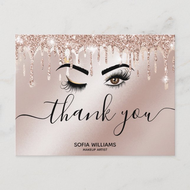 Wink Beautiful Brown Eye with Gold Crown  Postcard (Front)