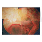 Wound 2004 (Front Horizontal)