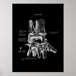 Wrist Anatomy Medical Poster Orthopedic Decor