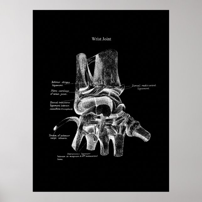 Wrist Anatomy Medical Poster Orthopedic Decor (Front)