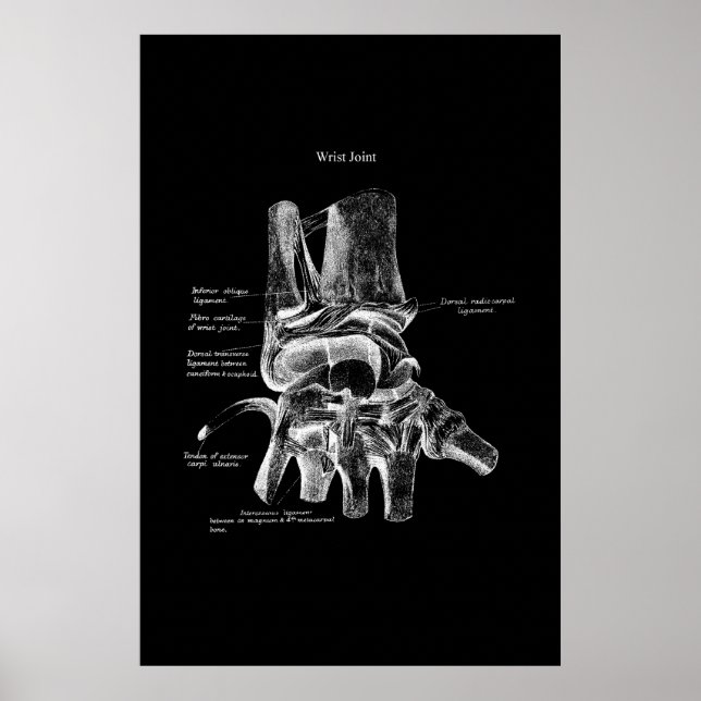 Wrist Anatomy Medical Poster Orthopedic Decor (Front)