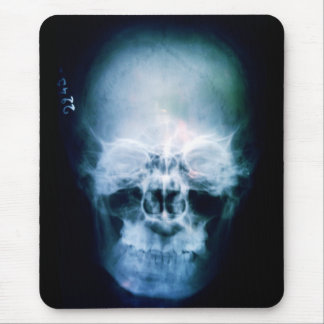 X-Head Mouse Pad