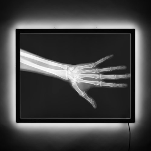 X_Ray Arm LED Sign
