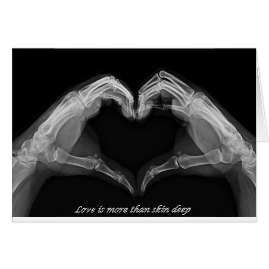 X-Ray Art Cards (Front Horizontal)