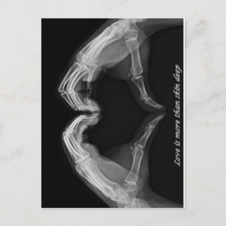 X-Ray Art Postcard
