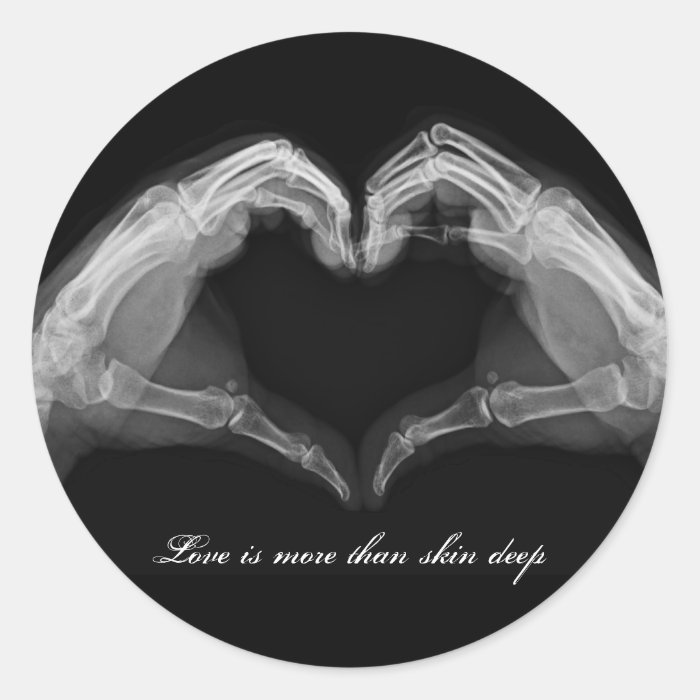 X Ray Art Round Stickers