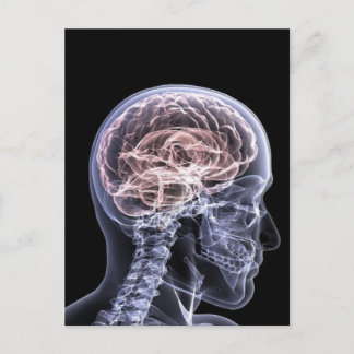 X-Ray Brain Postcard