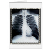 X-Ray Chest (Front)