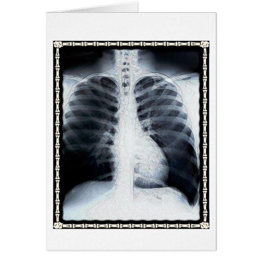 X-Ray Chest Cards (Front)