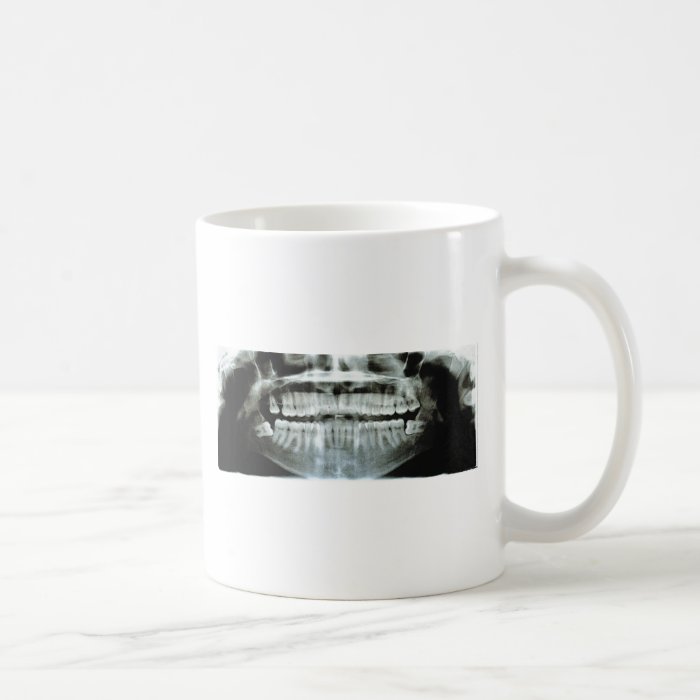 X Ray Coffee Mugs