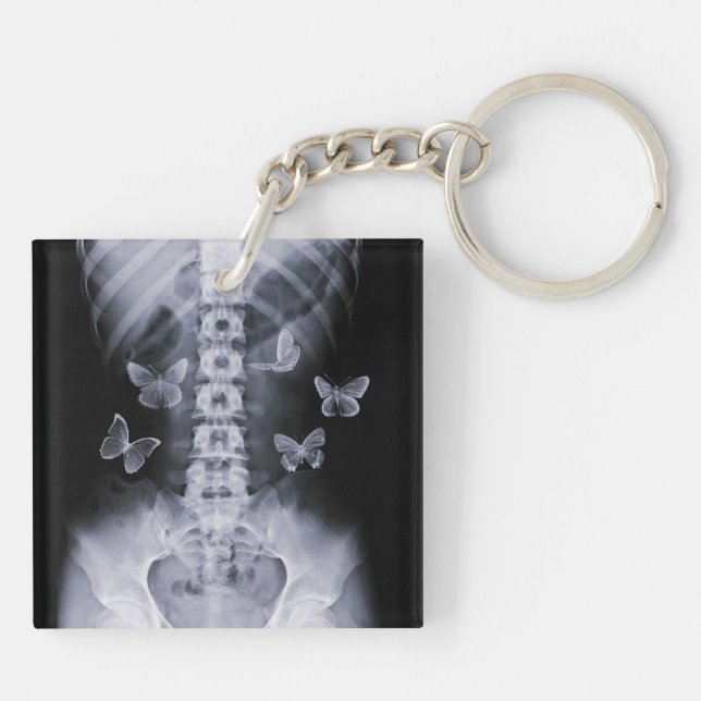 X-Ray Conceptual Butterflies Keychain (Back)