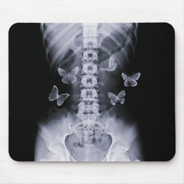 X-Ray Conceptual Butterflies Mousepad (Front)