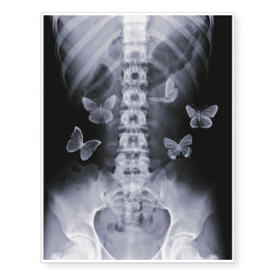 X-Ray Conceptual Butterflies Temporary Tattoo