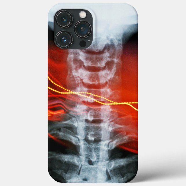 X-Ray Digital Artwork Phone Case (Back)