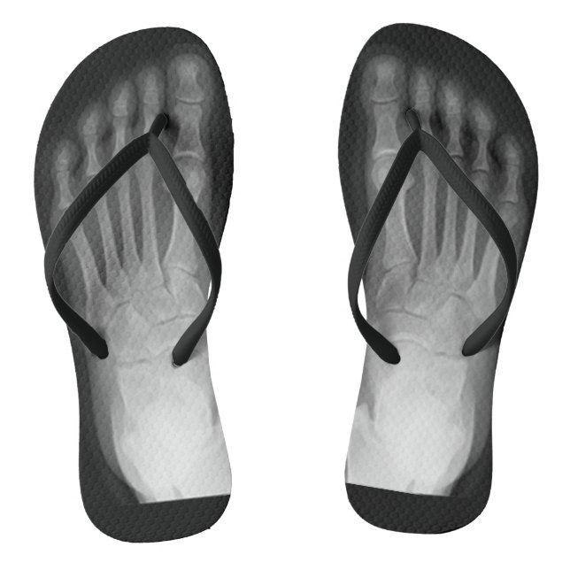 X-Ray Feet! Flip Flops (Footbed)