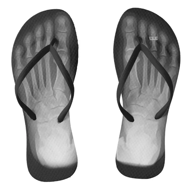 XRay Feet Flip Flops (with toe ring) Zazzle