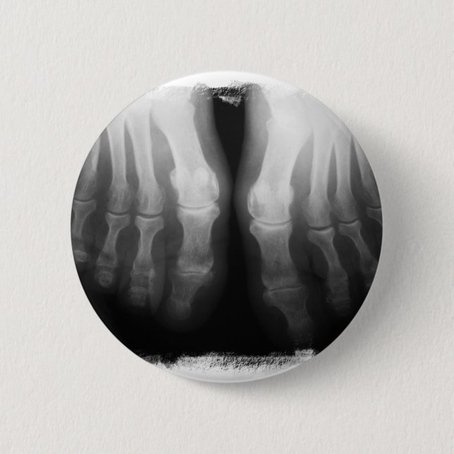 X-Ray Feet Human Skeleton Bones Black & White Button (Front)