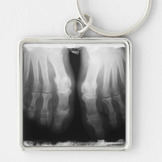 X-Ray Feet Human Skeleton Bones Black & White Keychain