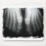 X-ray Feet Human Skeleton Bones Black &amp; White Mouse Pad at Zazzle