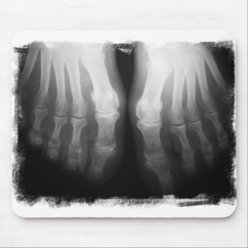 X-ray Feet Human Skeleton Bones Black & White Mouse Pad by VoXeeD at Zazzle